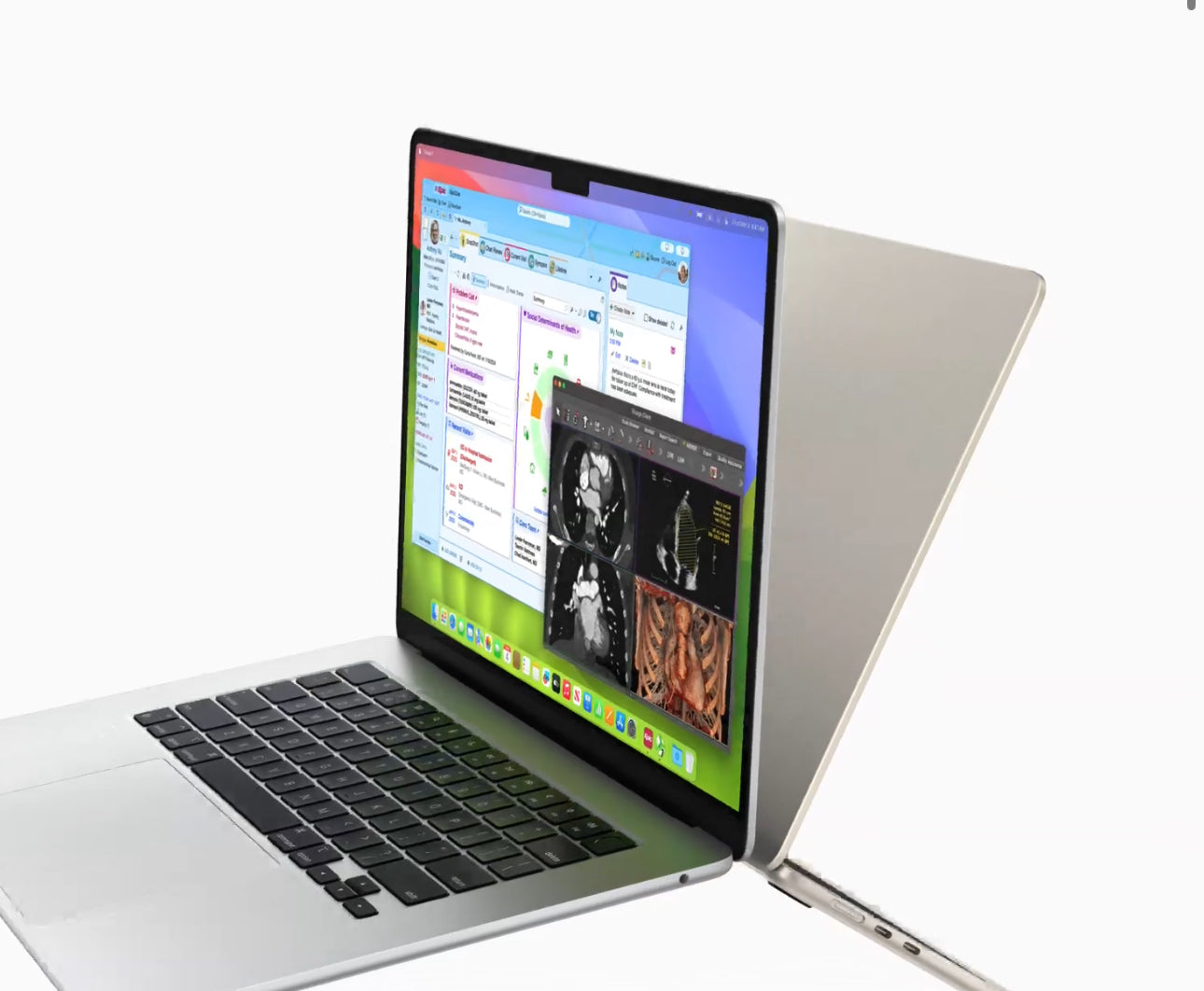 MacBook Air (13 inch M3)